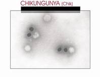 Chkungunya