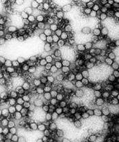 TEM micrograph: virus amarillico, arbovirus (234,000x magnification).